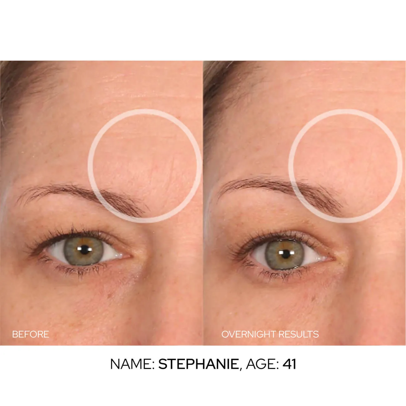 Mid-BrowLift Value Packs